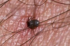 Tick on leg copy.jpg